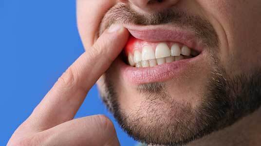 What is Periodontal disease and how can I treat this?