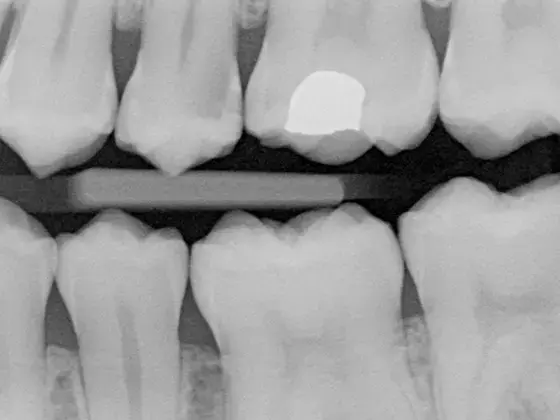 Dental X-rays at Ryde Dental