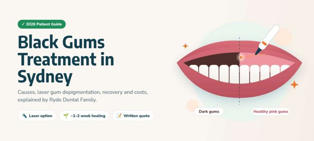 Black Gums Treatment in Sydney: Causes, Options & Costs (2026 Guide)