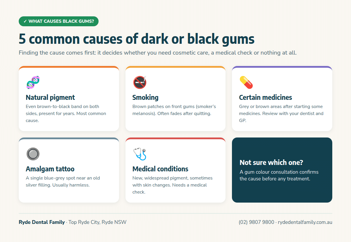 Infographic of five common causes of black gums: natural pigment, smoking, certain medicines, amalgam tattoo and medical conditions