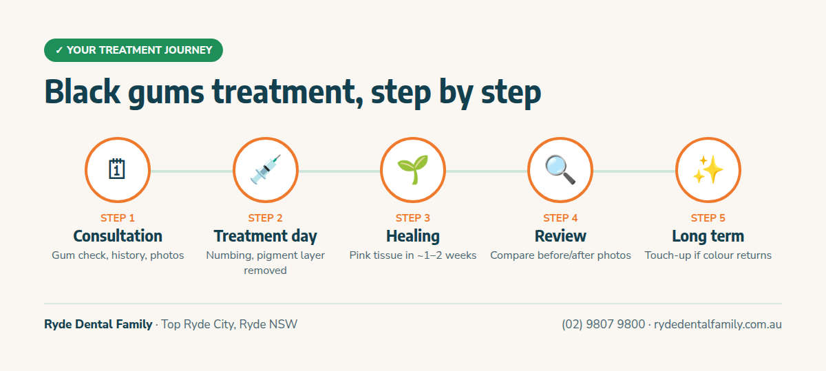 Five-step infographic of gum depigmentation: consultation, treatment under numbing, about one to two weeks of healing, a review visit, and a touch-up in the long term if colour returns