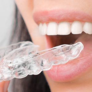 Close up of a young woman adjusting transparent aligners. Taking care of teeth. Orthodontic treatment for straightening and whitening teeth